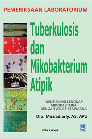 Pemeriksaan Laboratorium: Tuberkulosis Dan Mikobakterium Atipik
